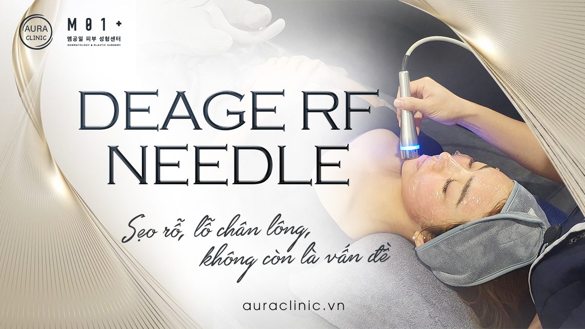 Deage RF Needle