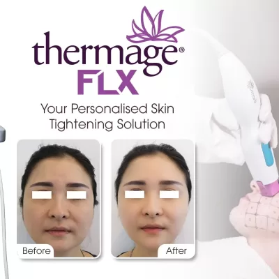 Thermage-clinic-in-ho-chi-minh