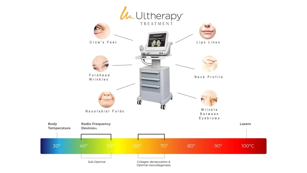Aura Clinic Ultherapy 2