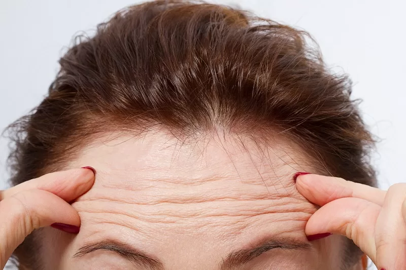 Forehead wrinkles botox injection in Ho Chi Minh city 1 jpg